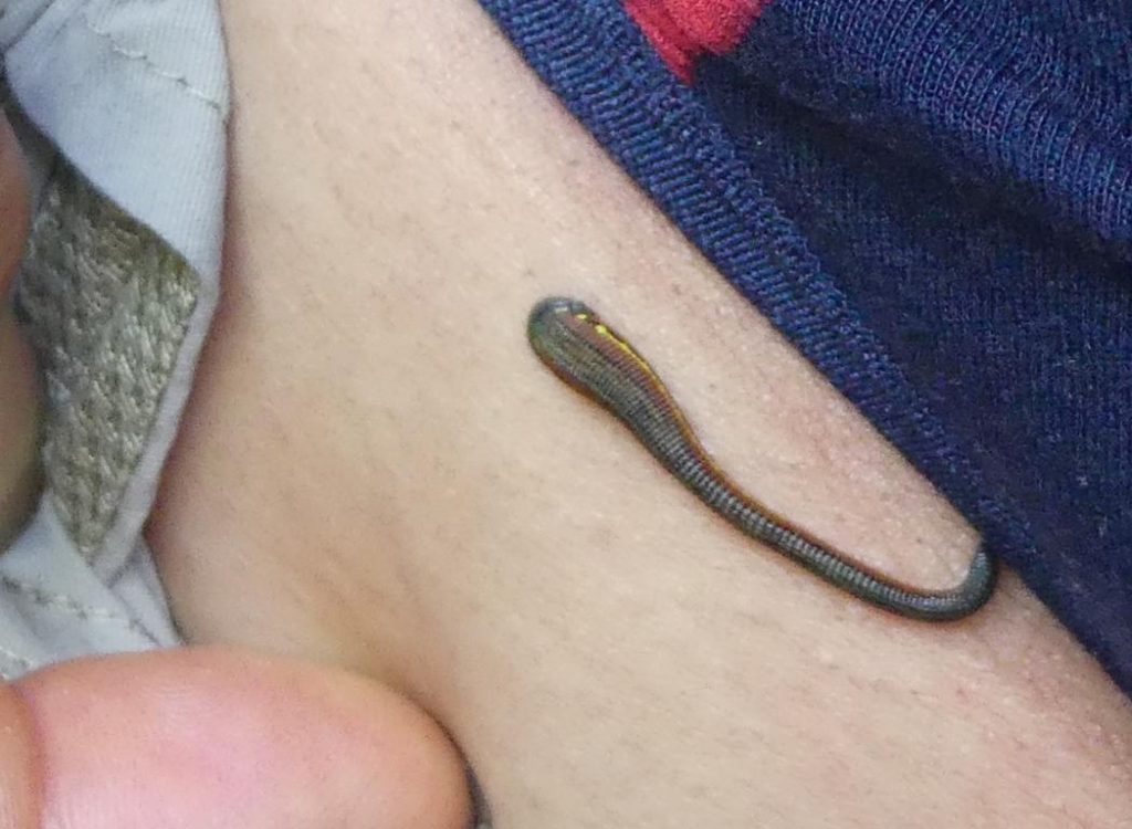 A leech on a delicate spot